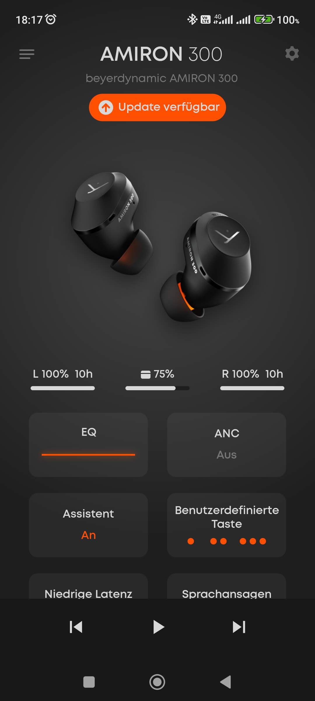 02_beyerdynamic_amiron_300_main